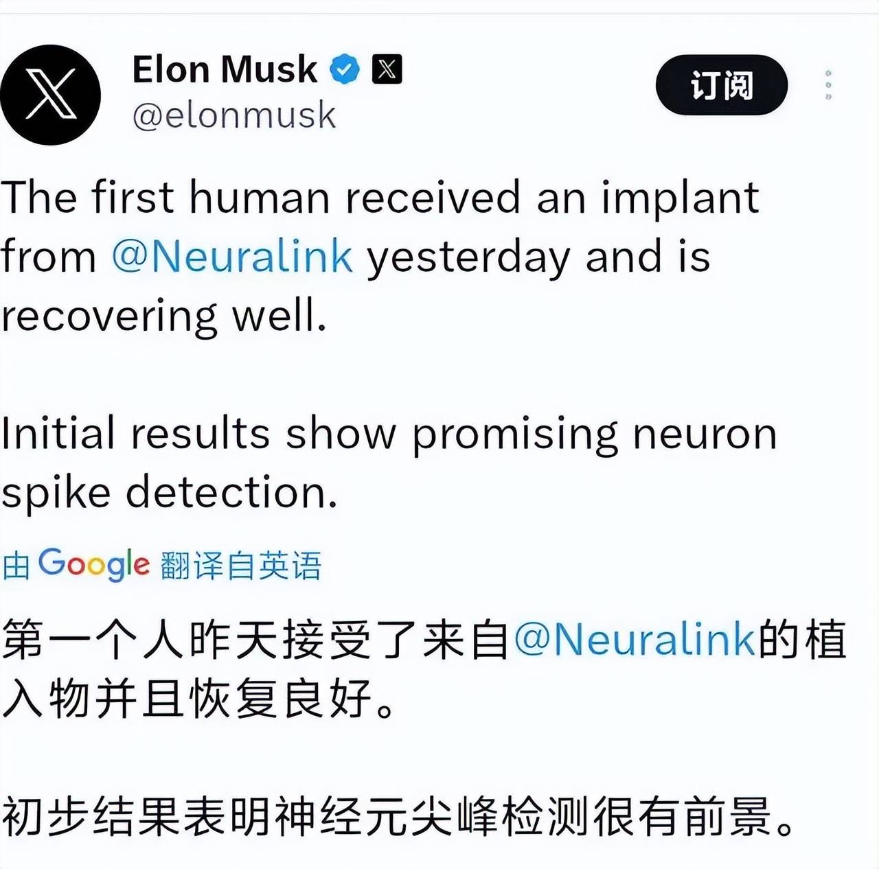Elon Musk's Neuralink Chip Implant
