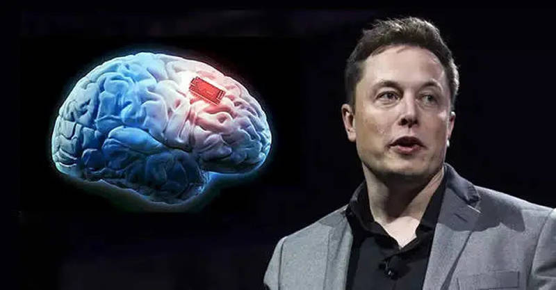 Elon Musk's First Brain Chip Implant