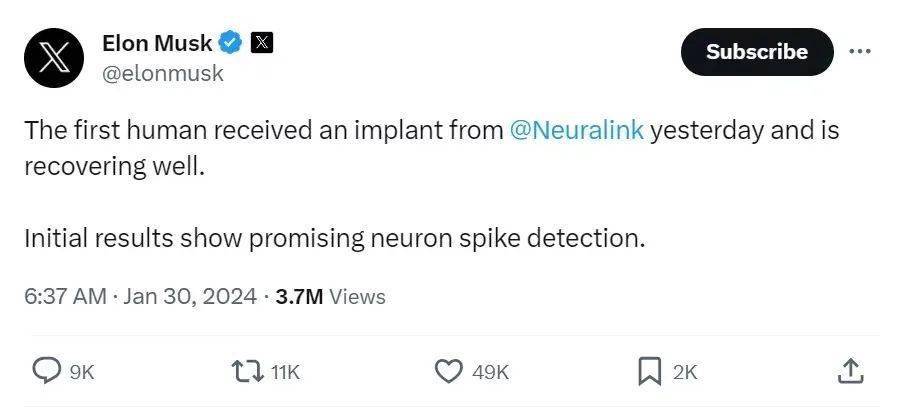 Elon Musk's Brain Chip Implant
