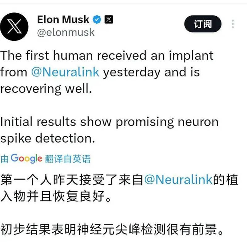 Elon Musk's First Brain Chip Implant